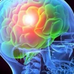 Инсульт снижает способность мозга к обучению