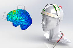 Электростимуляция мозга помогает справиться с инсультом