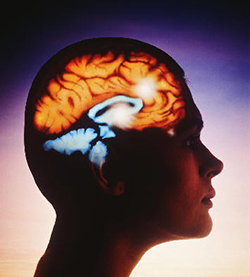 Возможность повторного инсульта