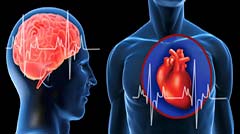 В чем разница между инфарктом и инсультом?