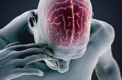 Стволовой инсульт: что это такое, прогноз выздоровления, последствия