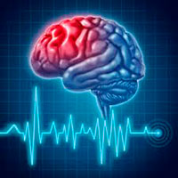 Об инсульте 